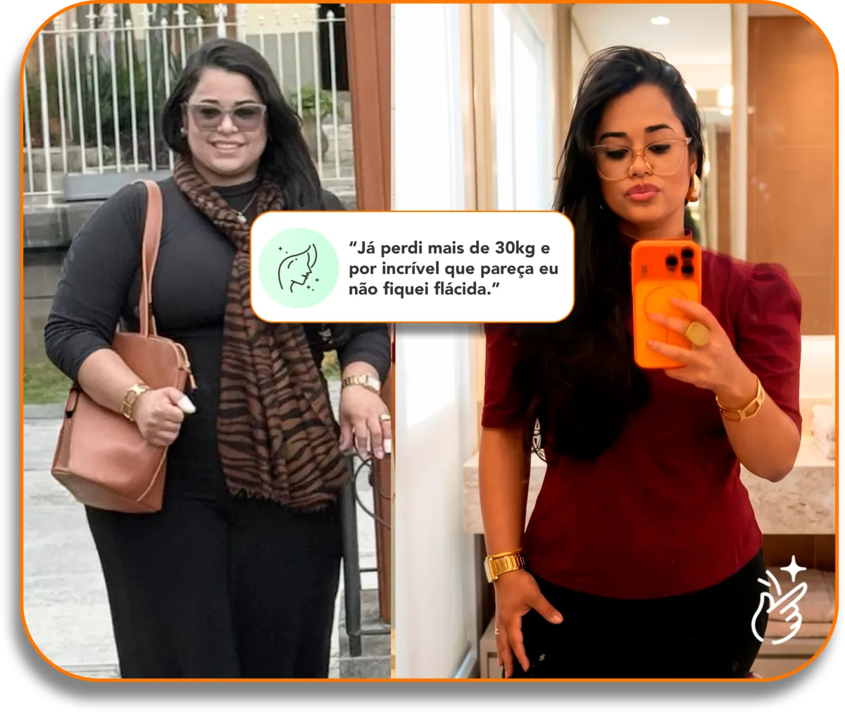 Resultado real: perda de mais de 30kg sem flacidez com Magra em Casa